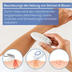 Beurer Insektenstichheiler